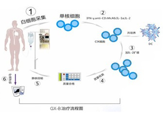 白癜风GX-B治疗流程图